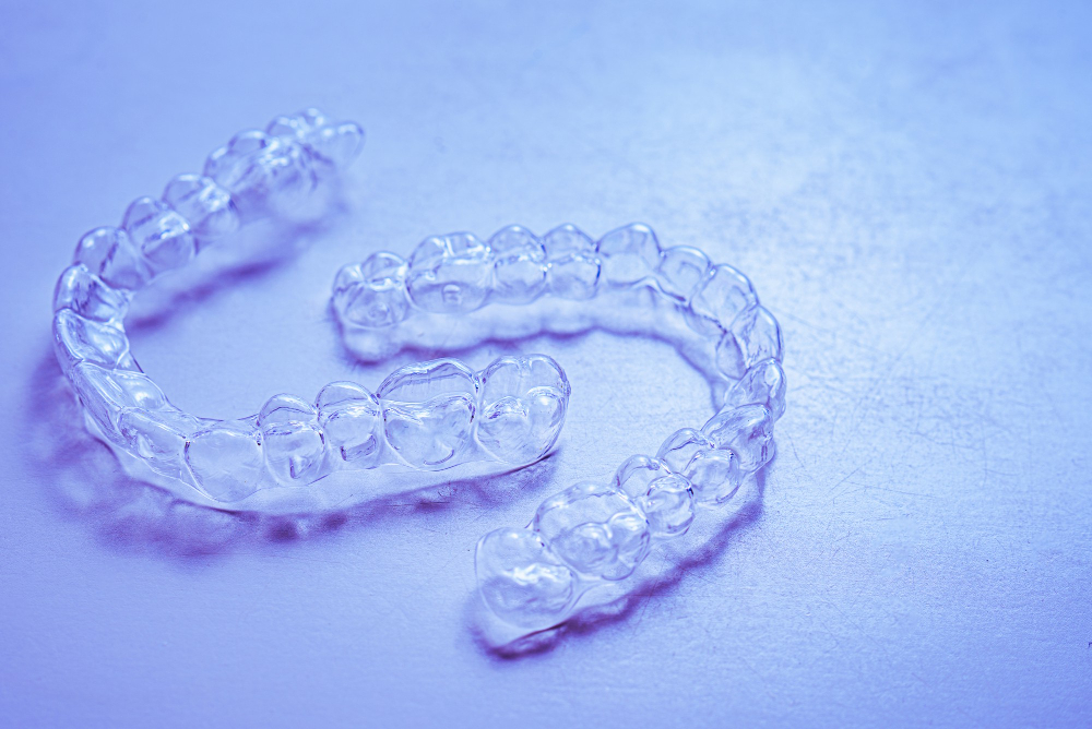 Suresmile Clear Aligners Will Change Your Smile